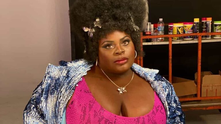 JoJo Todynho decide retirar balão gástrico após perder 14 quilos