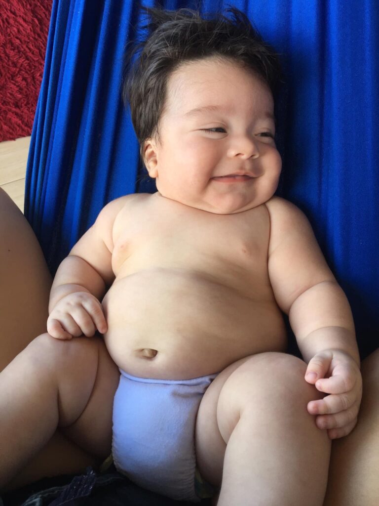 No AC, mãe pede ajuda para pagar cirurgia de bebê de 3 meses com malformação na uretra