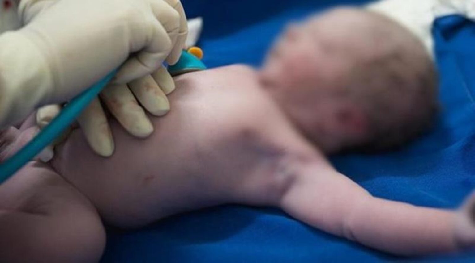 Bebê de 1 ano que caiu em piscina não resiste e morre em hospital de Rio Branco