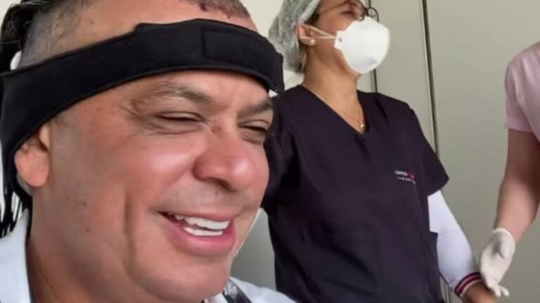 Frank Aguiar faz transplante capilar: ‘Isso me incomodava um pouco’