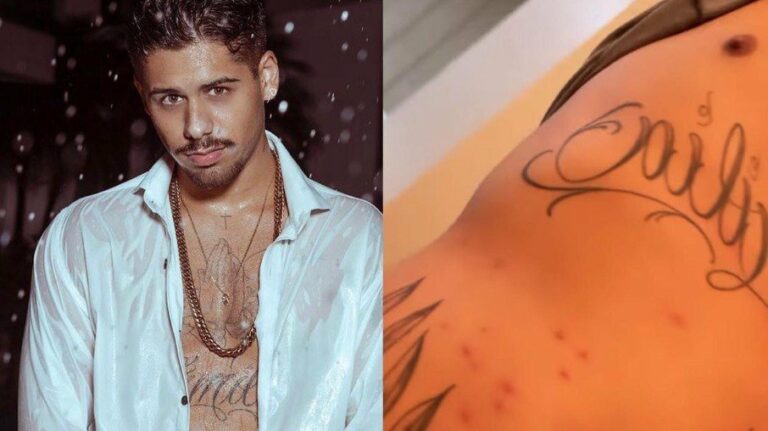 Zé Felipe revela que está com carrapato, não com sarna: ‘Tomei ivermectina’