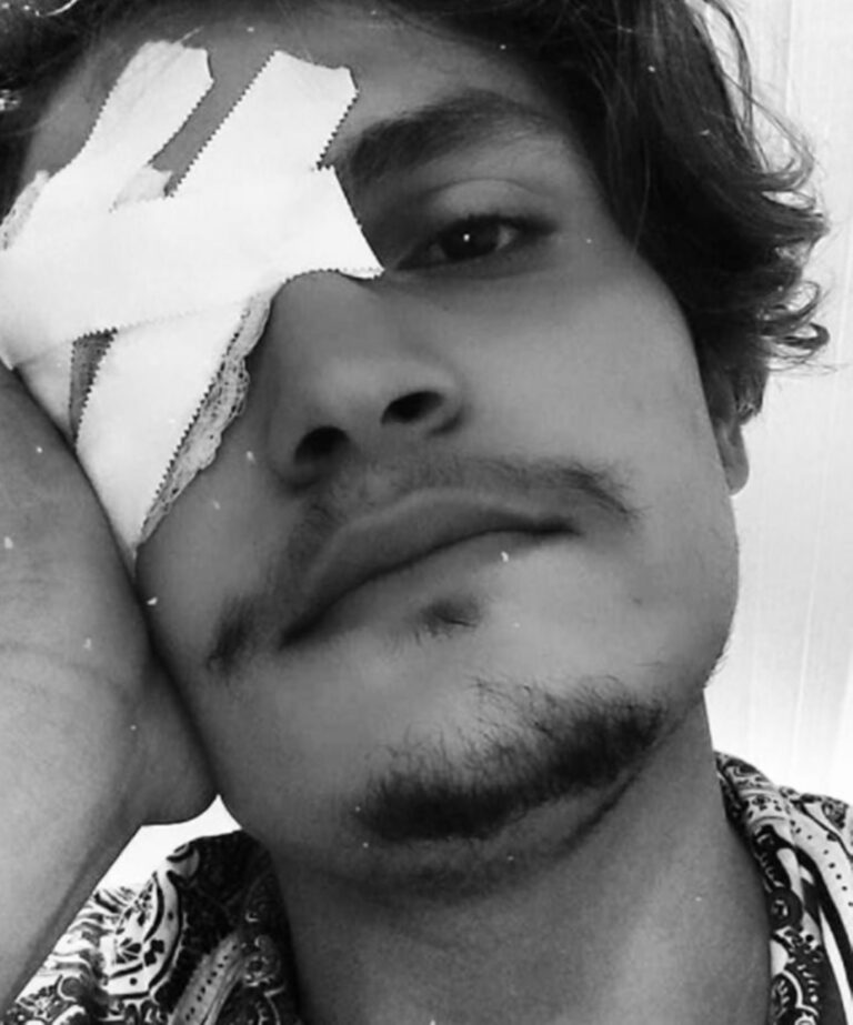 Artista acreano tem olho atingido por chave de fenda em conveniência de Rio Branco