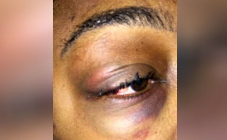 Esposa invade gabinete, espanca suposta amante de secretário e faz ameaças