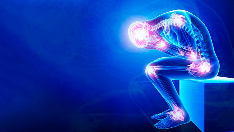 “Doença difícil, solitária e cara”: conheça a história de pessoas que vivem com fibromialgia