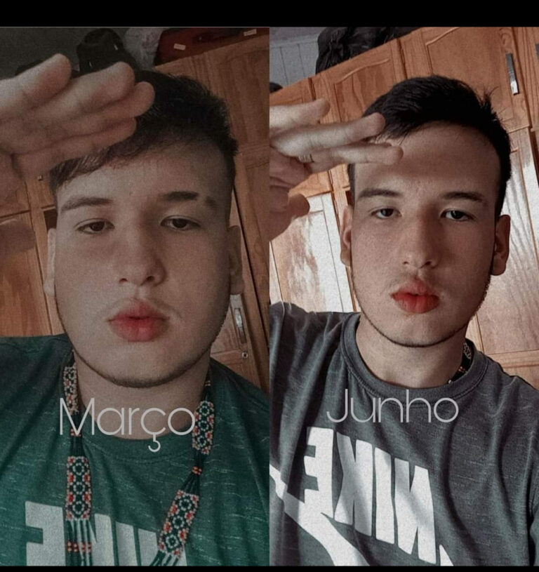 Família pede doação de sangue para salvar a vida de jovem na UTI do PS de Rio Branco