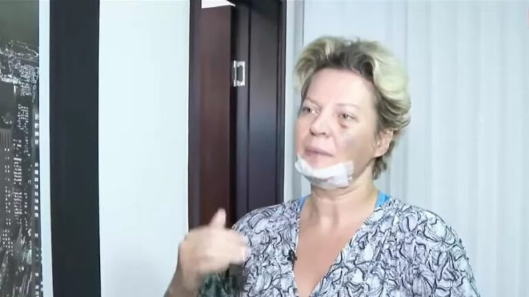 Joice entregou à polícia nomes de quem suspeita ter relação com ferimentos