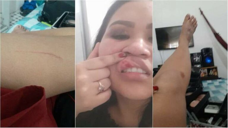Mulher é agredida por homem com socos e câmera flagra crime; VÍDEO