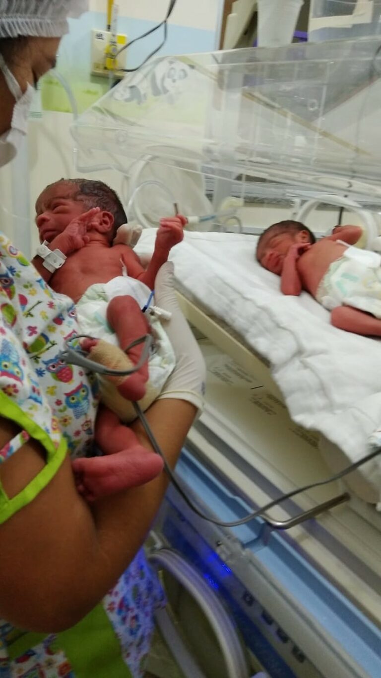 Mãe relata susto ao descobrir 3º bebê durante parto de gêmeos no AM: ‘Me levantei para ver se era verdade’