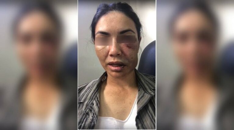 Motorista de app é espancada por ladrões e finge desmaio para não ser morta