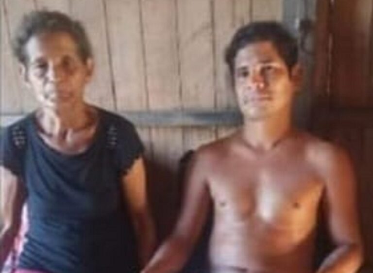 Santa Rosa do Purus: Homem de 30 anos fica paraplégico ao fraturar a coluna durante acidente curioso