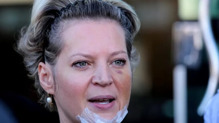 Polícia Civil conclui que Joice sofreu ‘queda’ e descarta agressão