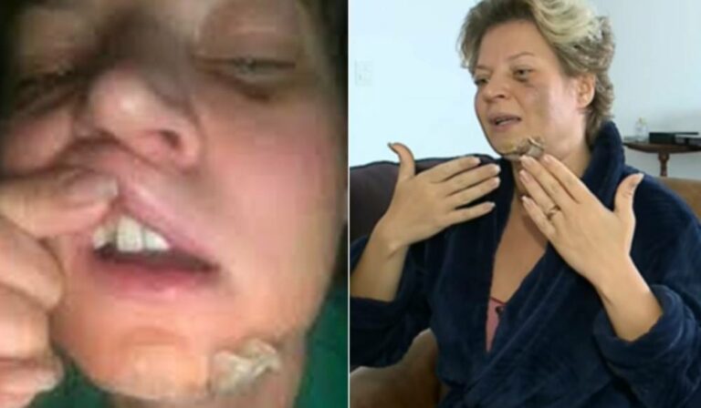 Remédio usado por Joice é ligado a relatos de apagão de memória e até acidentes