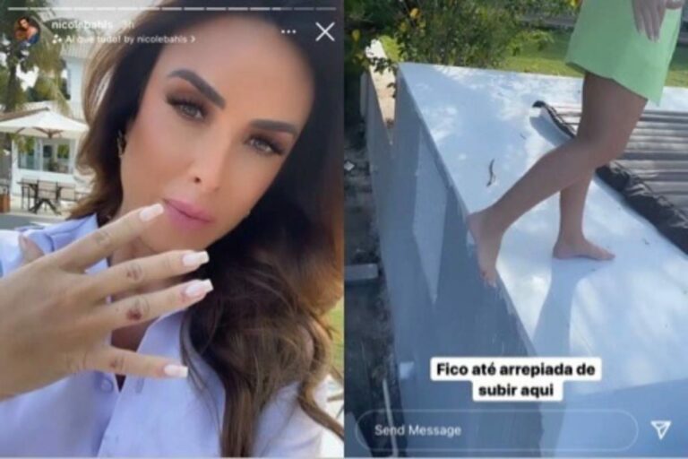 Nicole Bahls sofre acidente em casa: “Me machuquei toda”