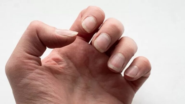 O que as unhas podem indicar sobre a sua saúde