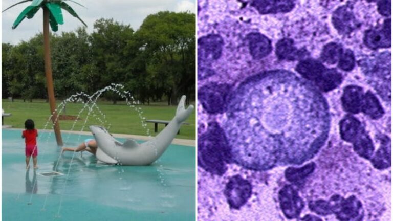 Criança morre após ser infectada por ameba “comedora de cérebros”