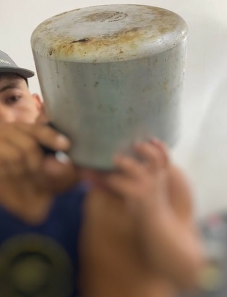 Menino de dois anos é levado a UPA após ficar com panela de pressão presa na cabeça