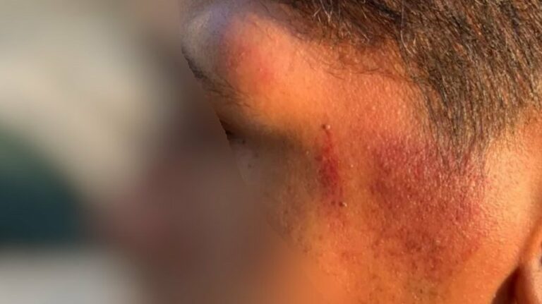 Policiais agridem casal gay com socos e chutes em abordagem