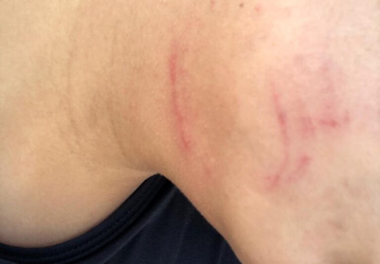 Hospitalizada: Marido espanca mulher que o chamou pelo nome de suposto amante