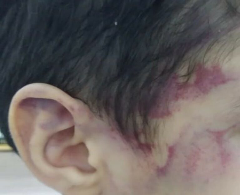 Lutador de muay thai é suspeito de espancar e torturar enteado de 5 anos