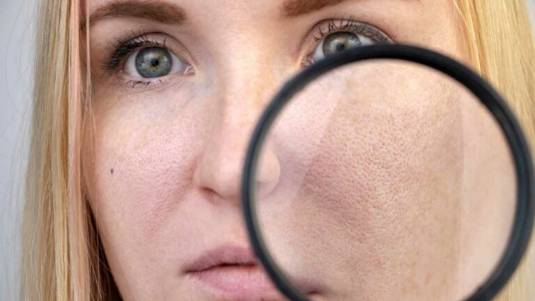 Pele de porcelana: 5 truques para tê-lo assim com o mínimo de esforço