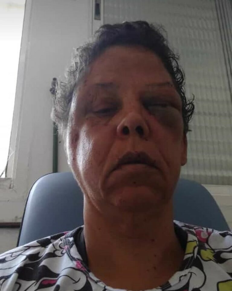 Mulher é agredida de forma brutal ao reagir a assalto no litoral de SP; VÍDEO