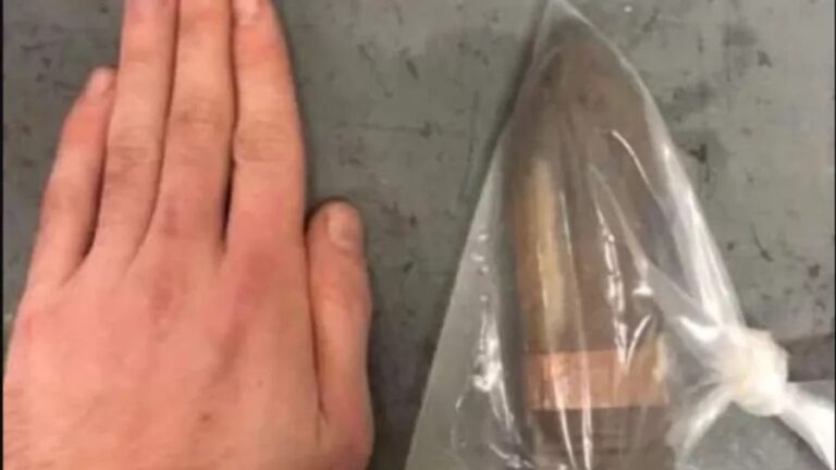 Homem com projétil de canhão no reto faz hospital acionar equipe antibomba