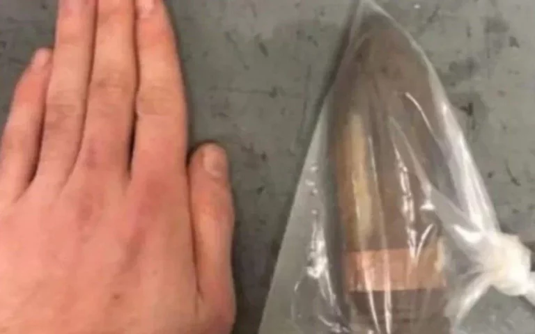 Homem com projétil de canhão no reto faz hospital acionar equipe antibomba