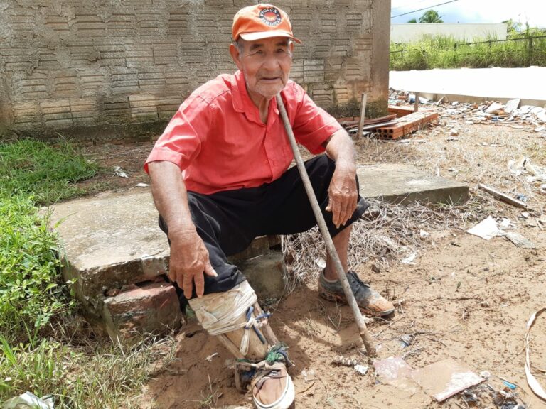 Indígena picado por cobra jararaca em Sena Madureira pede ajuda para comprar prótese