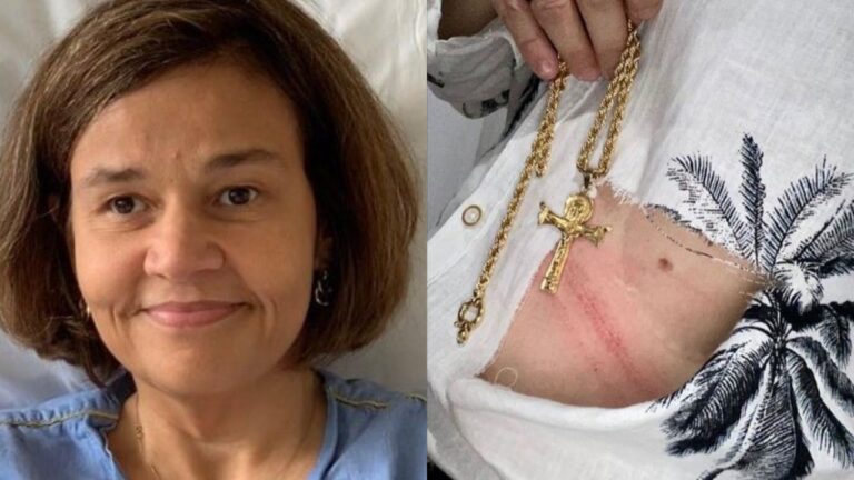 Claudia Rodrigues passa por momento assustador ao ser vítima de assalto: “Susto”