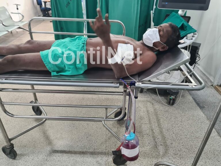 Nego Bau é agredido e está em estado grave após ter costelas e dedos quebrados e pulmão perfurado