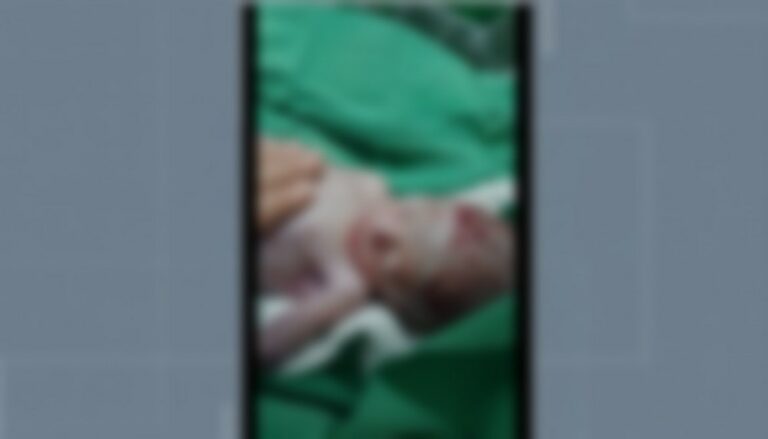 Em Rondônia, agente funerário descobre que bebê dado como morto estava respirando