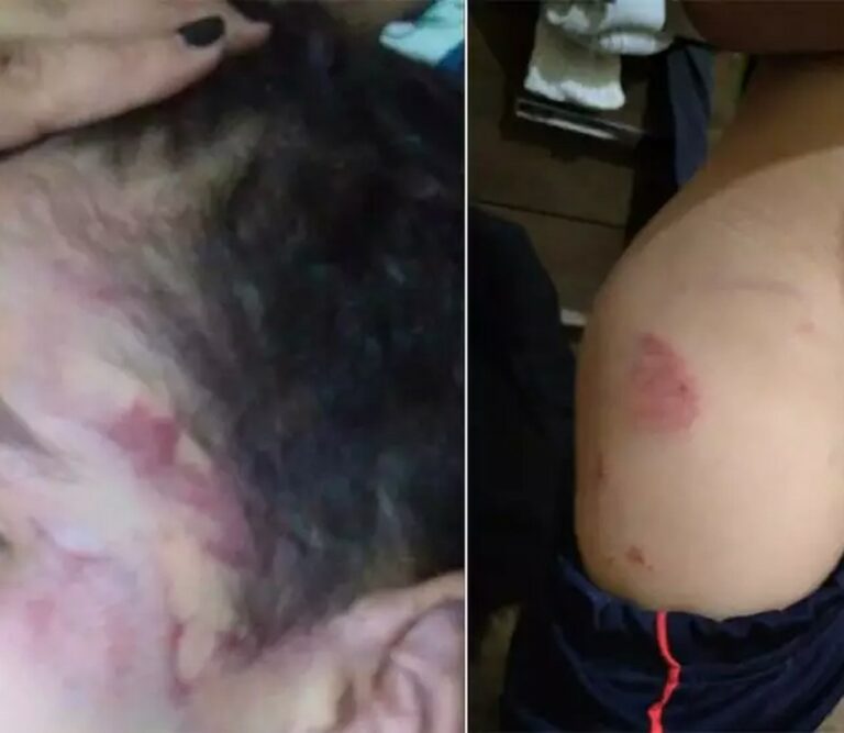 ‘Perdi a paciência e dei socos no rosto e em todo corpo’, diz lutador de muay thai suspeito de espancar enteado de 5 anos