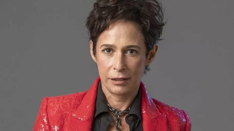 Andréa Beltrão comenta resultado de plástica: “Tive um ataque”