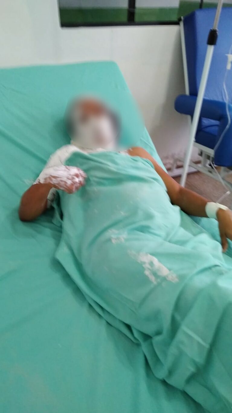 Filho ateia fogo na mãe grávida após ela se recusar a lavar roupa