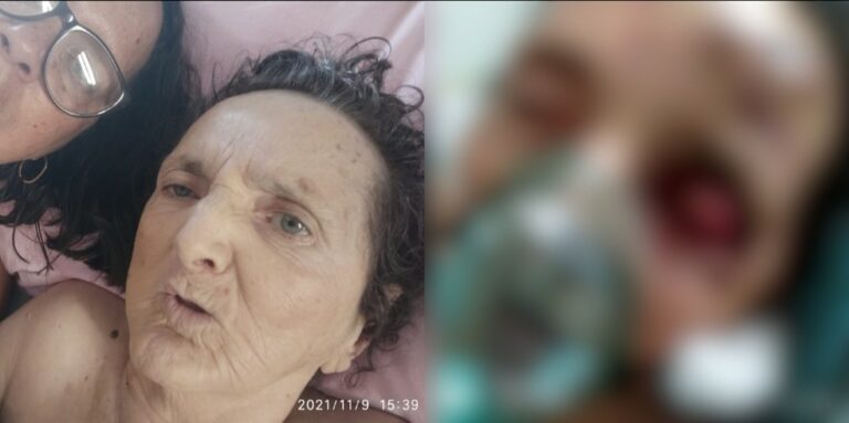 Idosa morre após armário de hospital despencar sobre cabeça dias antes de alta médica