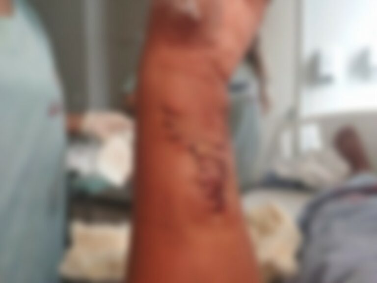 Sem aceitar fim do namoro, rapaz esfaqueia conhecido da ex e acaba preso