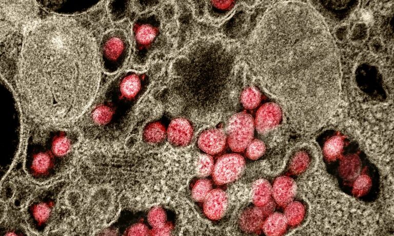 Ômicron: conheça os cinco sintomas da nova variante do coronavírus