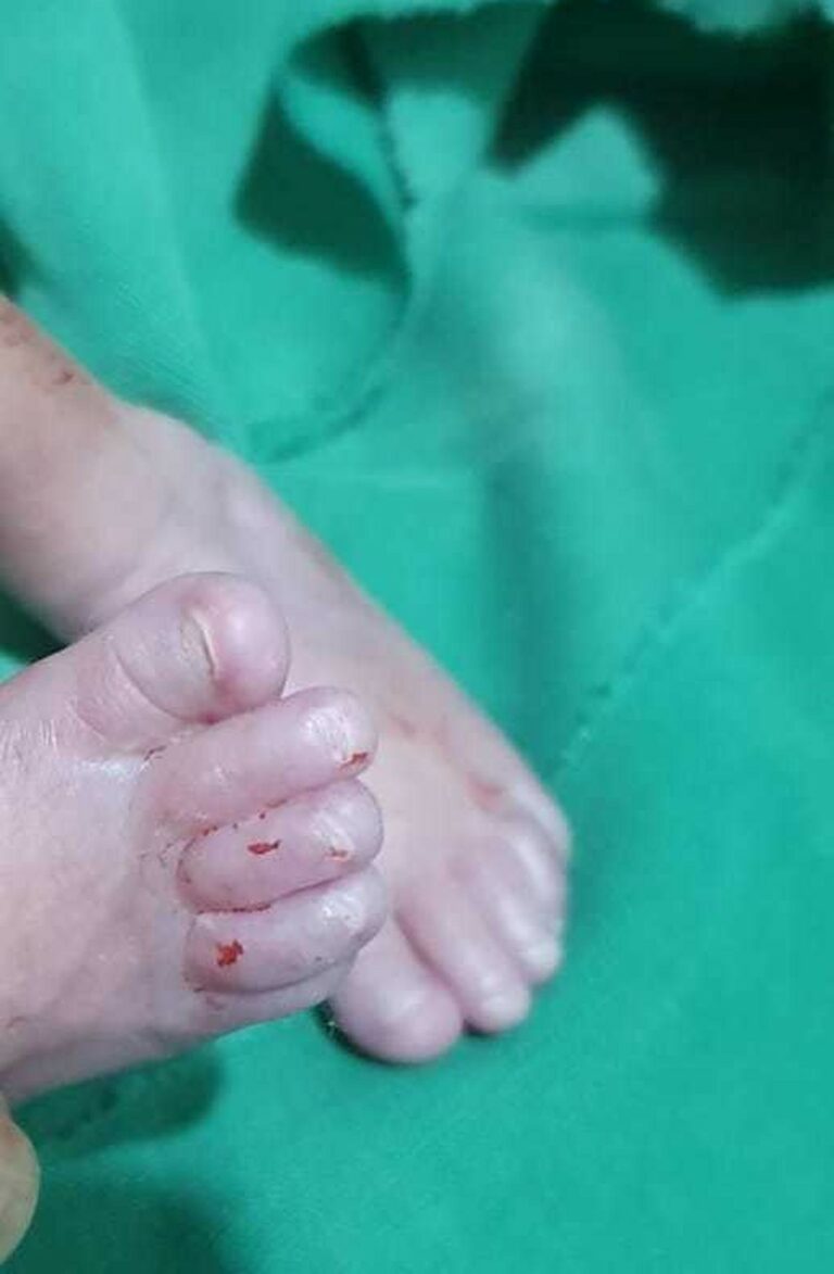 Bebê levado vivo para funerária morre após 15 dias internado em UTI: ‘negligência imperdoável’, diz avó