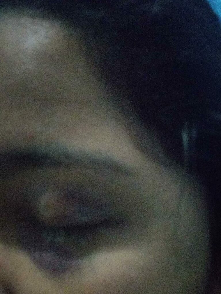 Mulher é espancada pelo companheiro com socos, chutes e a golpes de capacete no interior do Acre