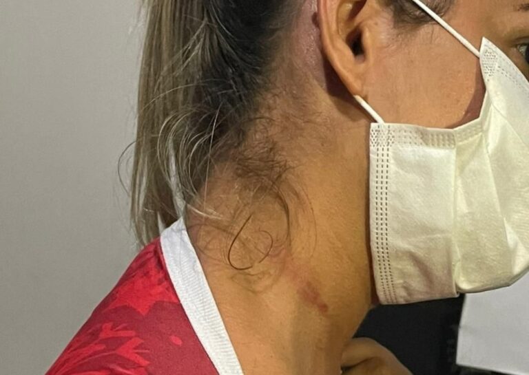 Agressão à primeira-dama de Porto Walter gera tensão e embates na cidade