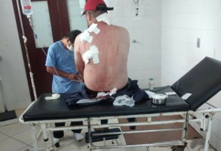 Comerciante é atingido por vários tiros e se salva de atentado