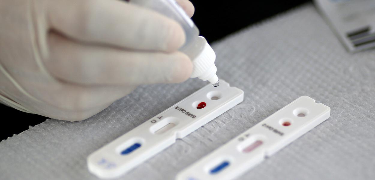 De R$ 45 a R$ 70, autotestes para Covid chegam às farmácias em março