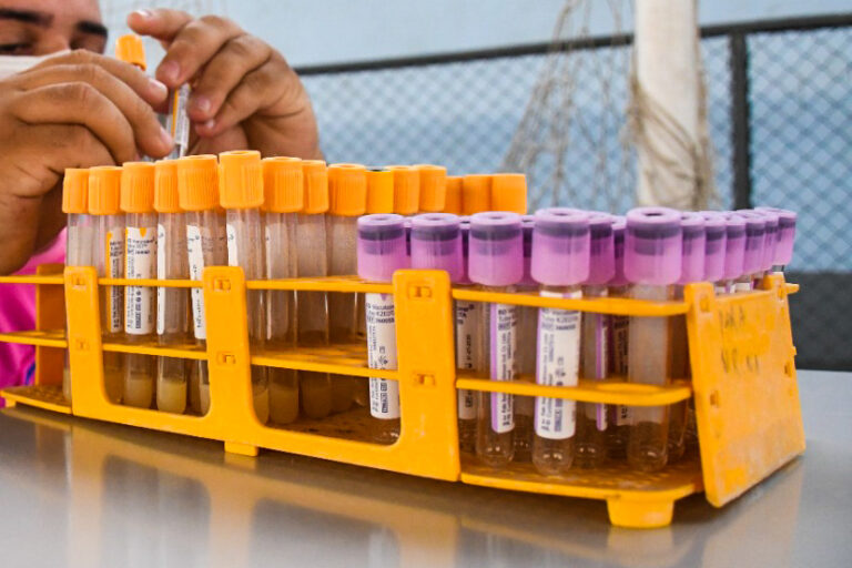 Prefeitura de Cruzeiro do Sul adquire mais testes da Covid-19