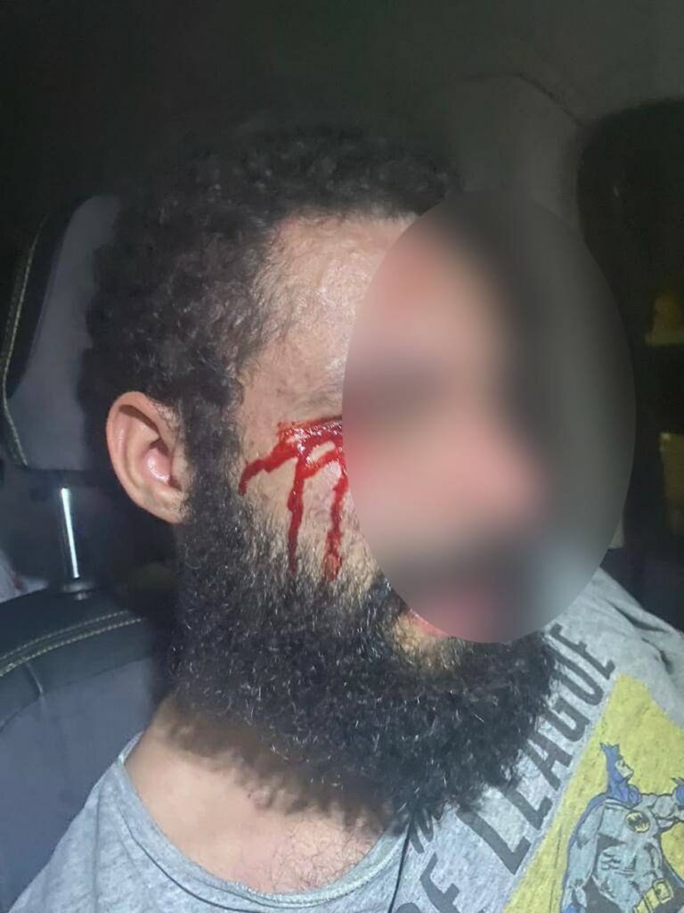 Condenada por mandar cortar pênis do ex, médica é investigada por agredir e torturar marido