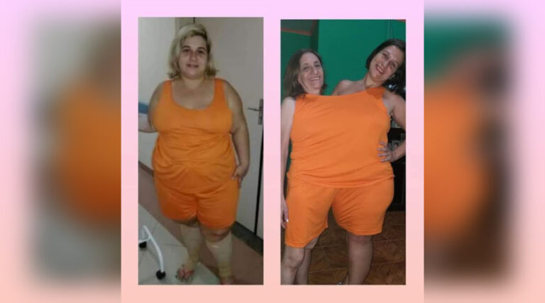 Após drama da obesidade, acreana conta como perdeu 55 quilos: “Não tinha mais estímulo para viver”