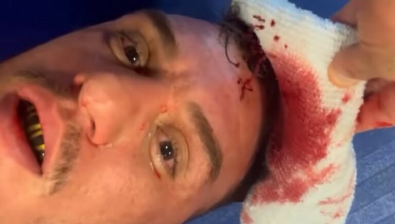 IMAGEM FORTE! Cabeçada a duas semanas nos treinos quase tira Renato Moicano do UFC 271