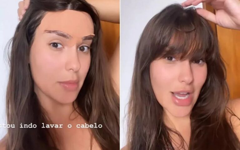 Ex-BBB Thais mostra cicatrizes após diminuir a testa