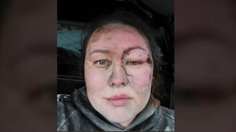 Treinadora ucraniana é “enterrada viva” e choca em meio à guerra