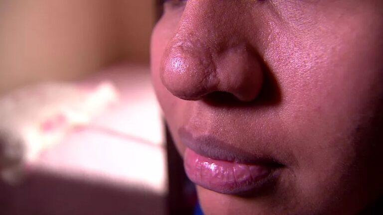 ‘Meu nariz ficou necrosado’, diz paciente de falsa biomédica presa em Manaus