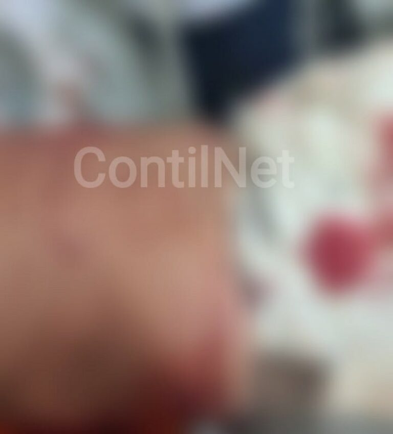 PMs atiram em homem que tentava tirar a própria vida em Rio Branco